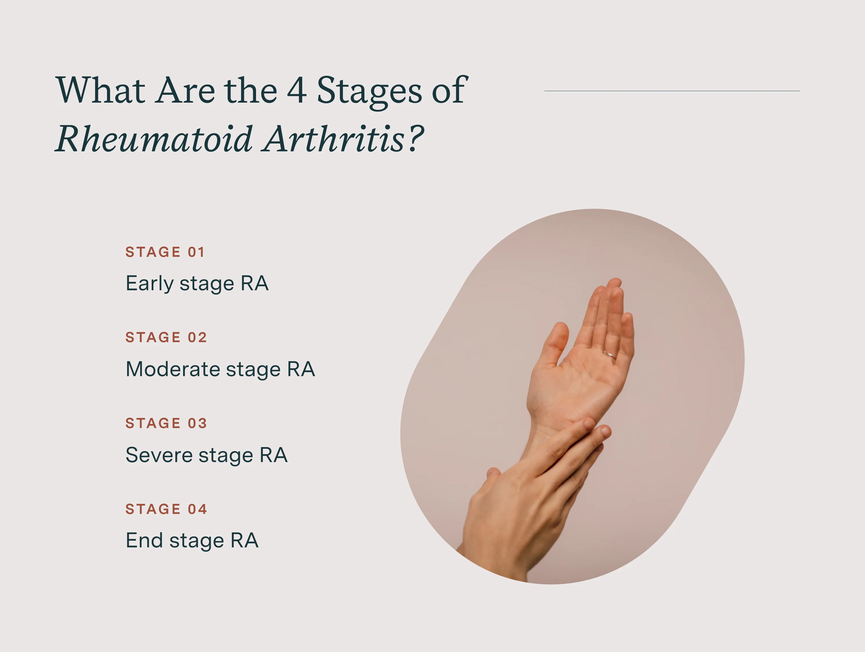 what are the 4 stages of rheumatoid arthritis